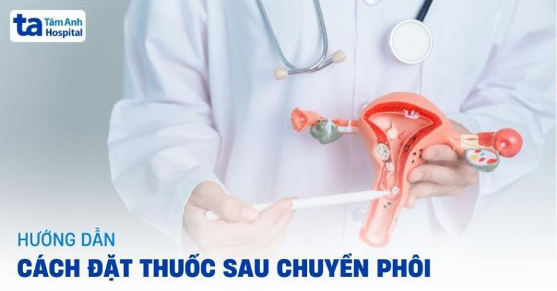 Thuốc Đặt Sau Chuyển Phôi: Hỗ Trợ Thai Làm Tổ Như Thế Nào?