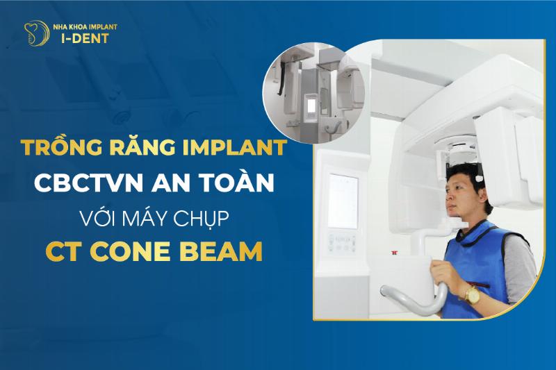 Hình ảnh kết quả chụp CT Cone Beam cho thấy răng khôn mọc ngầm và vị trí dây thần kinh
