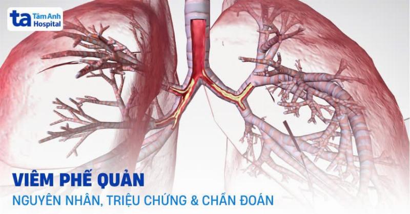Đau họng: Các Phương Pháp Điều Trị Hiệu Quả Bạn Cần Biết