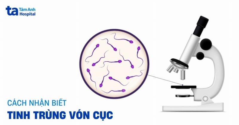 Hình ảnh minh họa các lầm tưởng phổ biến về tinh trùng gặp trứng.