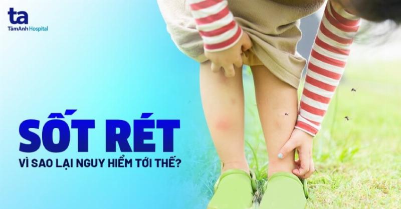 Biểu hiện của Bệnh Sốt Rét: Dấu hiệu nhận biết Sớm và Nguy hiểm