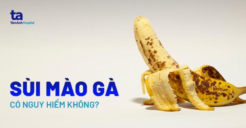 Sùi Mào Gà Để Lâu Có Sao Không Những Biến Chứng Khôn Lường