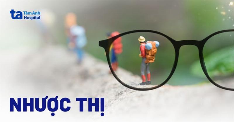 Nhược Thị Có Khiến Bạn Bị Mù Vĩnh Viễn Không? Giải Đáp Chi Tiết