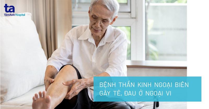 Viêm Dây Thần Kinh Ngoại Biên Uống Thuốc Gì? Giải Đáp Cùng Chuyên Gia