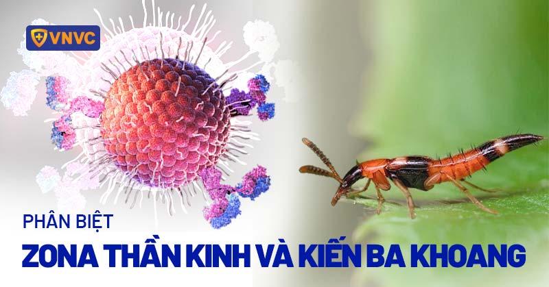 Vết Kiến Cắn Sưng To: Tại Sao Lại Như Vậy Và Làm Sao Khắc Phục Hiệu Quả?