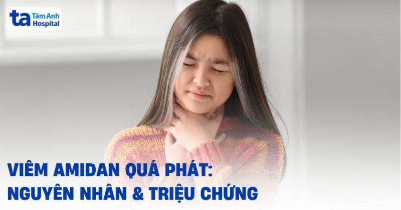 Viêm Amidan Quá Phát Độ 3: Hiểu Đúng Để Chăm Sóc Sức Khỏe