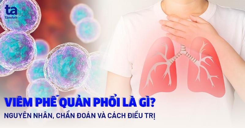 Viêm Phế Quản Là Bệnh Gì? Hiểu Rõ Để Chủ Động Bảo Vệ Sức Khỏe Hô Hấp