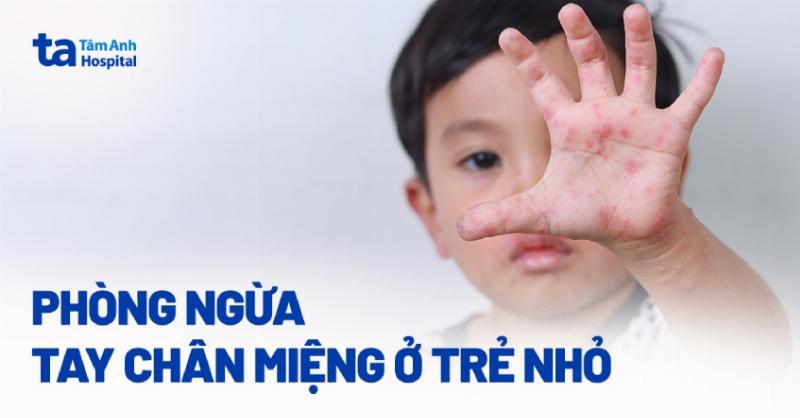 Biện pháp phòng ngừa bệnh tay chân miệng hiệu quả cho trẻ