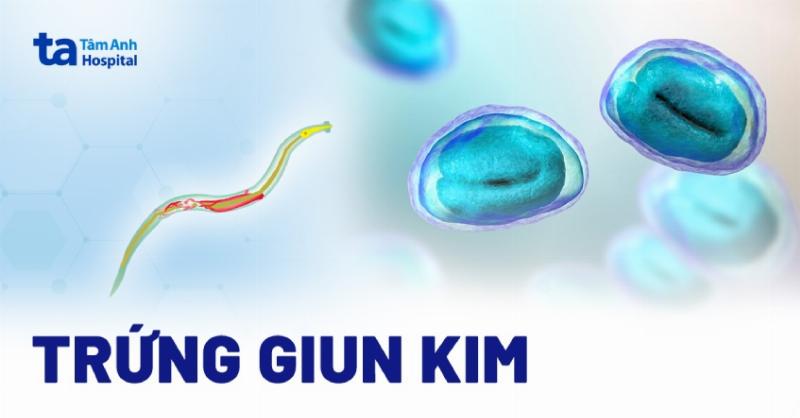 Hình minh họa các hoạt động phòng ngừa giun kim trong gia đình, bao gồm vệ sinh tay, giặt giũ, lau nhà, liên quan đến cách bắt giun kim ở bộ phận sinh dục nữ.