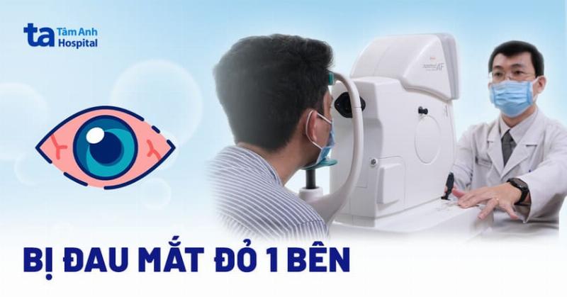 Cach phong ngua tinh trang mat tu nhien bi do mot ben tai dien
