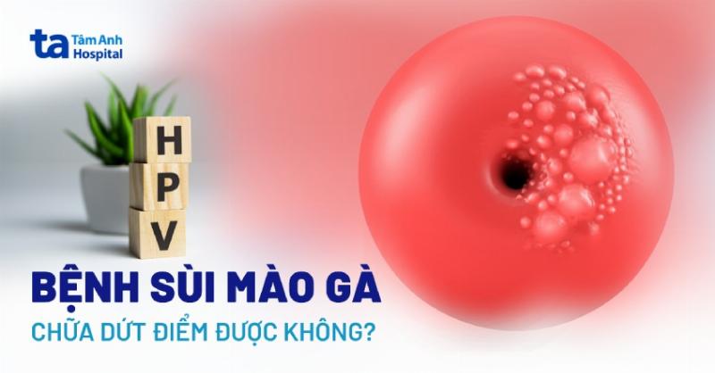 Sùi Mào Gà Ở Mặt: Hiểu Rõ Để Chủ Động Phòng Ngừa Và Đối Phó