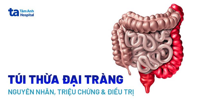 Cách chữa chướng bụng đầy hơi hiệu quả không ngờ ngay tại nhà