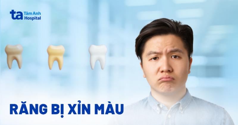 Làm Trắng Răng Nha Khoa: Bí Quyết Nụ Cười Rạng Rỡ An Toàn