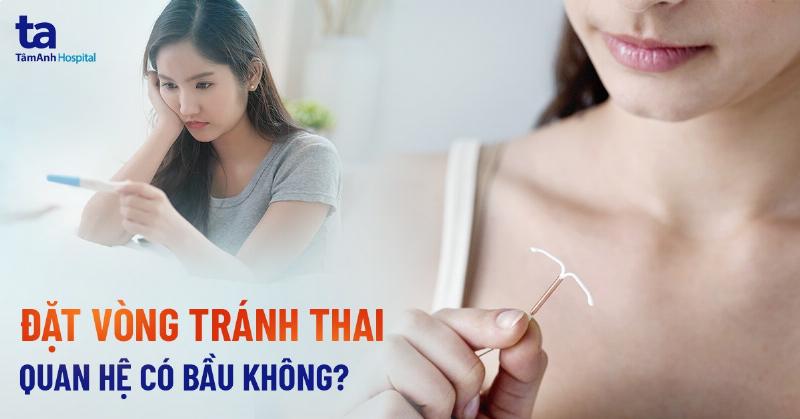 Đặt Vòng Có Thai Được Không? Sự Thật Từ Chuyên Gia Y Tế