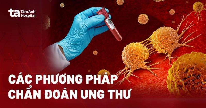 So sánh vai trò của mổ sinh thiết với các phương pháp chẩn đoán khác như xét nghiệm máu và chẩn đoán hình ảnh