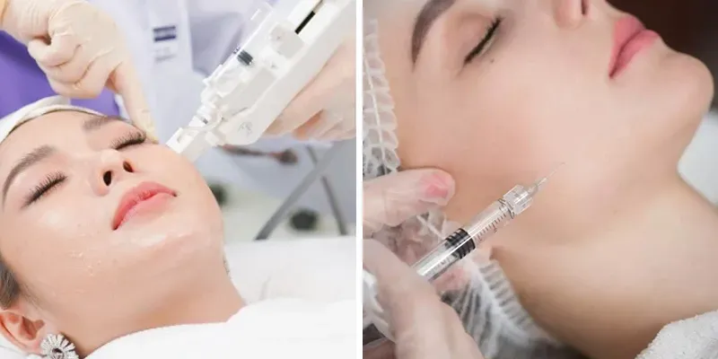 Tiêm Meso Có Hại Không? Chuyên Gia Da Liễu Thẩm Mỹ Giải Đáp Tận Gốc