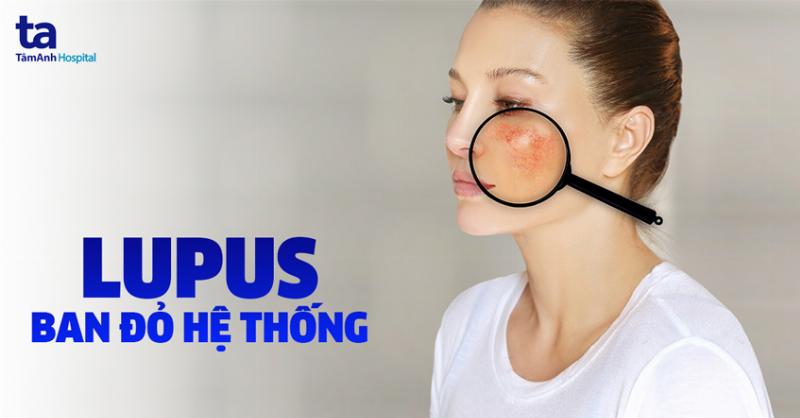 Uống Panadol Nhiều Có Sao Không? Chuyên Gia Giải Đáp Cặn Kẽ
