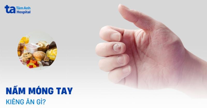 Bị nấm candida nên ăn gì? Chế độ dinh dưỡng chuẩn y khoa