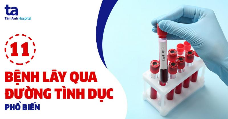 Các Bệnh Lây Qua Đường Tình Dục: Hiểu Đúng Để Tự Bảo Vệ Sức Khỏe