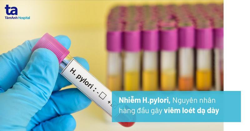 Đau Trên Rốn Là Đau Gì? Nguyên Nhân Và Khi Nào Cần Lo Lắng
