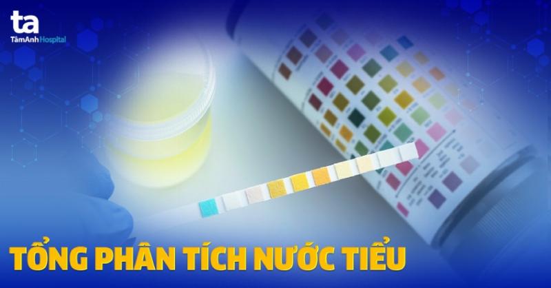 Tiểu rắt, tiểu buốt ở phụ nữ: Dấu hiệu, nguyên nhân và cách đối phó hiệu quả