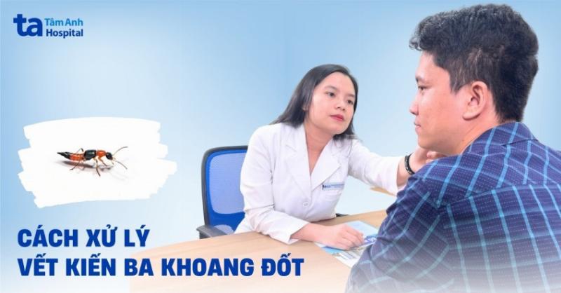 Xử Lý Kiến Ba Khoang Cắn: Hướng Dẫn Toàn Diện Từ Chuyên Gia